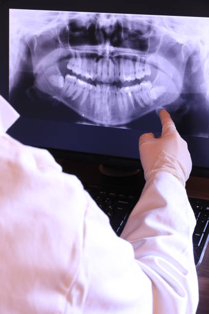Best Emergency Tooth Extraction in Woodlawn, OH