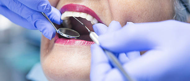 Best Emergency Wisdom Teeth Removal in Woodlawn, OH